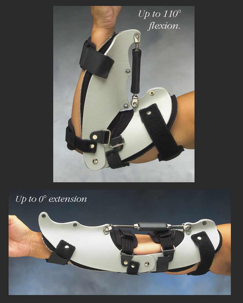 Progress Plus Elbow Turnbuckle Orthosis